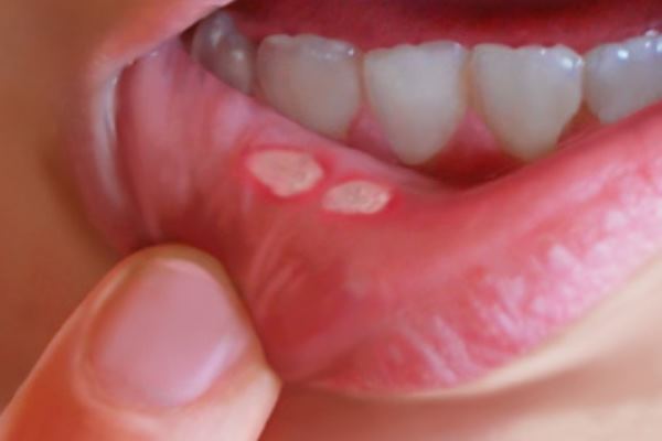 Cat Skin Sores Home Remedies Cat Skin Sores Home Remedies