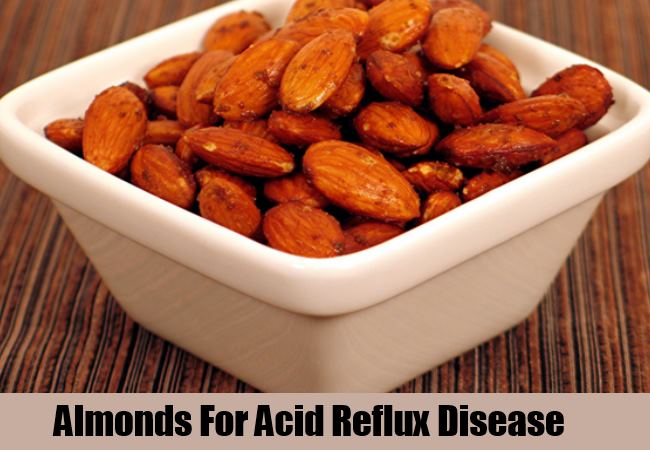 Almonds Almonds