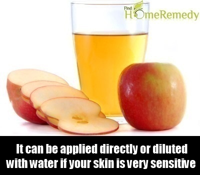 Apple Cider Vinegar Apple Cider Vinegar
