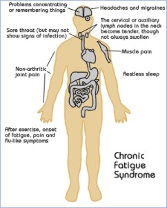 Cure Chronic Fatigue Syndrome