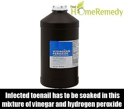 Hydrogen Peroxide 