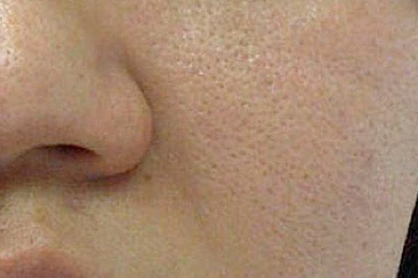 Large Pores