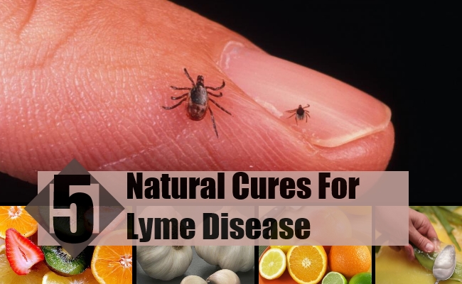 Lyme Disease Lyme Disease