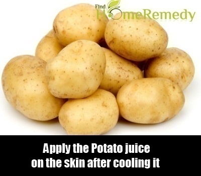 Potato Potato