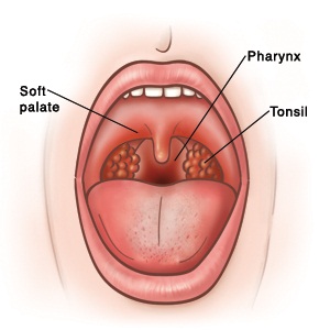 Home Remedies For Throat Infection