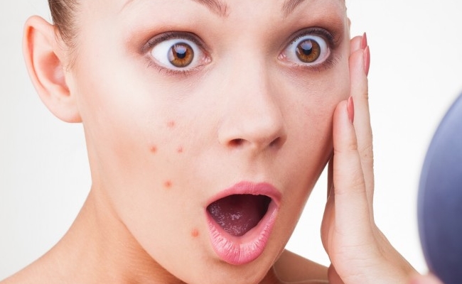 Works On Acne And Pigmentation Works On Acne And Pigmentation