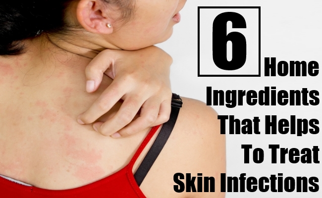 Home Ingredients That Helps To Treat Skin Infections