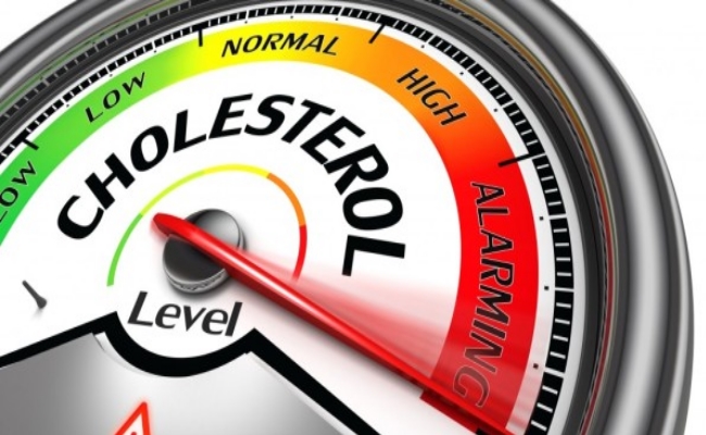 Cholesterol