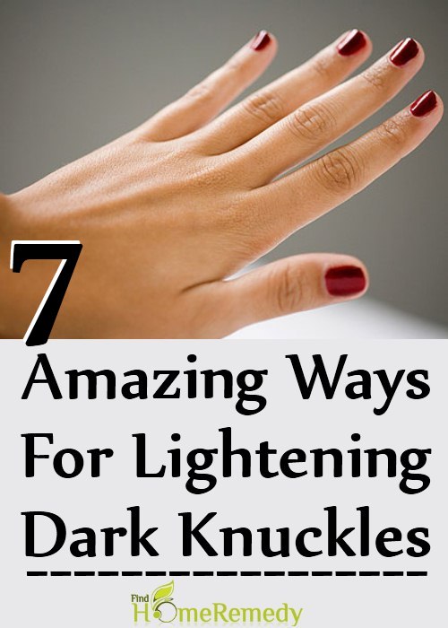 7 Amazing Ways For Lightening Dark Knuckles 7 Amazing Ways For Lightening Dark Knuckles