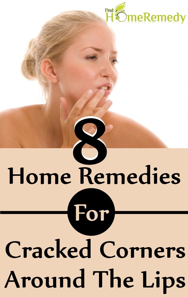 8 Home Remedies For Cracked Corners Around The Lips
