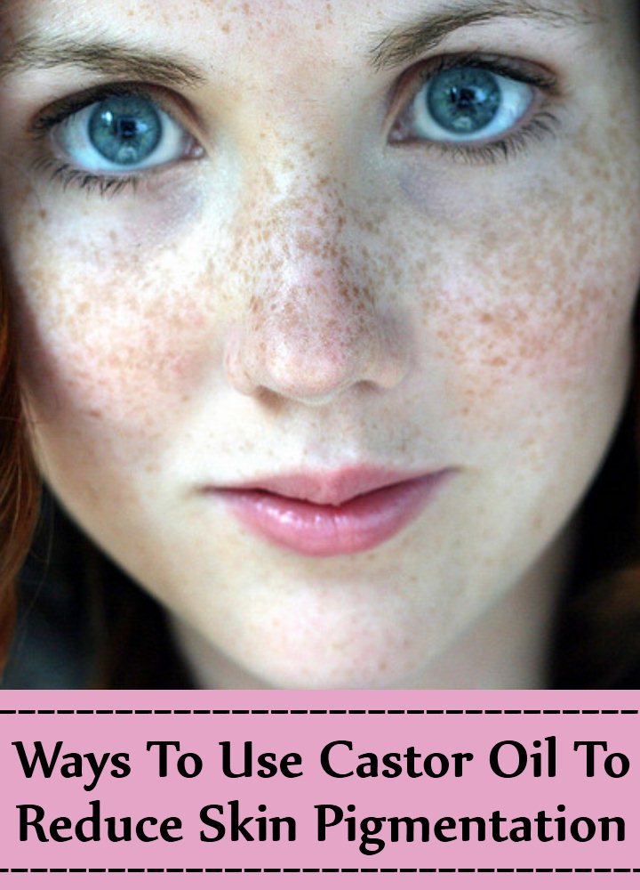 7 Ways To Use Castor Oil To Reduce Skin Pigmentation 7 Ways To Use Castor Oil To Reduce Skin Pigmentation